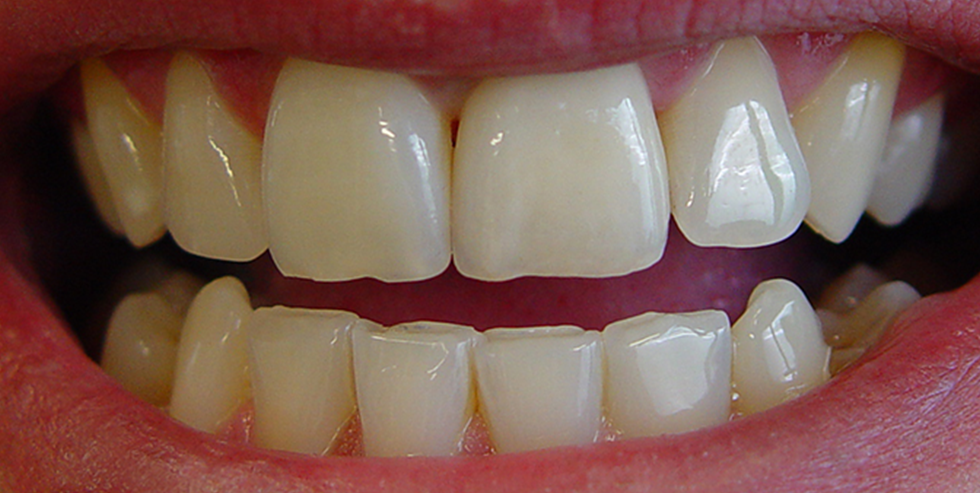 Urszula Młynarska's patient case Urszula Młynarska's patient case