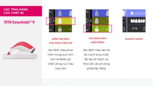VITA Easyshade V