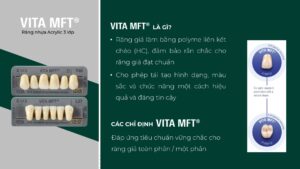VITA MFT®