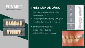 VITA MFT®