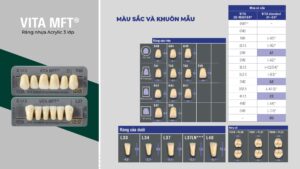 VITA MFT®