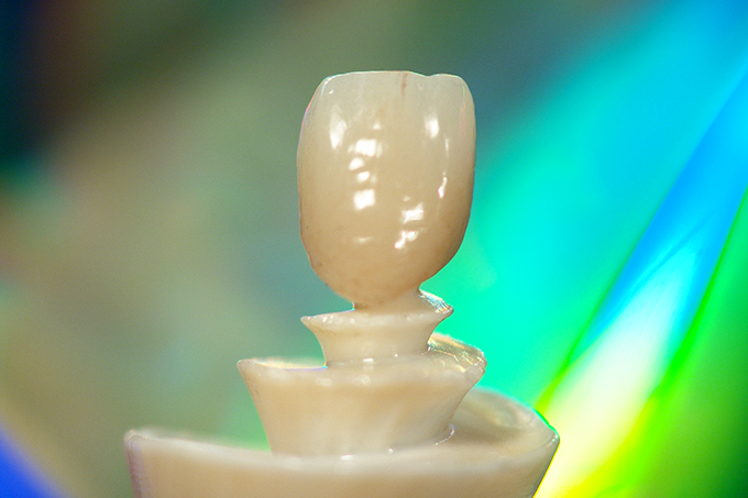 Completed crown Completed crown