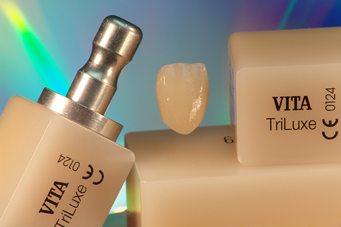Completed crown and VITABLOCS® TriLuxe Completed crown and VITABLOCS® TriLuxe