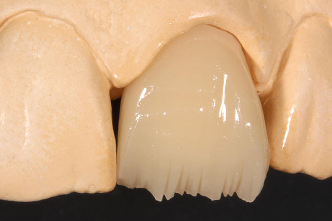 VITA ENAMIC Restoration prepared for individualization. VITA ENAMIC Restoration prepared for individualization.