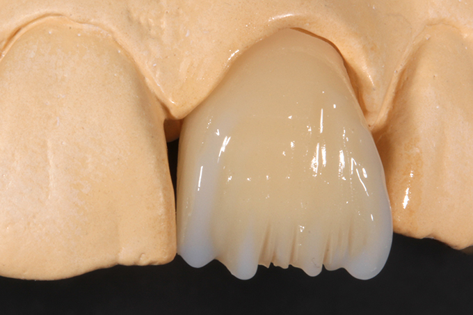 VITA EFFECT ENAMEL flow EE9 and EE2. VITA EFFECT ENAMEL flow EE9 and EE2.