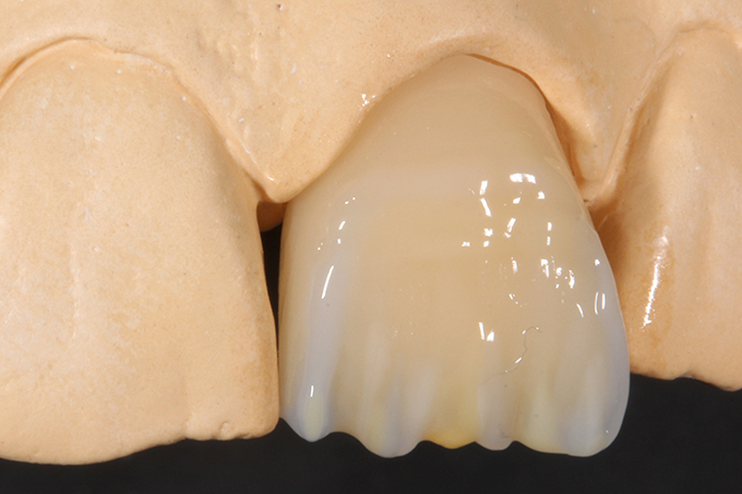 VITA EFFECT ENAMEL flow EE2 and EE5. VITA EFFECT ENAMEL flow EE2 and EE5.