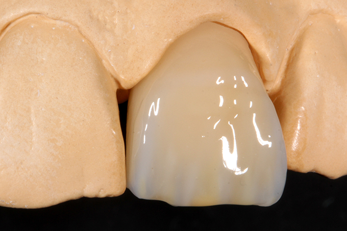 VITA EFFECT ENAMEL flow. VITA EFFECT ENAMEL flow.