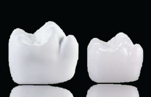Giải pháp VITA YZ