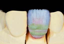  (Effect Enamel, trắng trong mờ) đã được thêm vào vài điểm để tạo đường nét mỏng, trắng